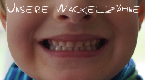 Unsere Wackelzähne